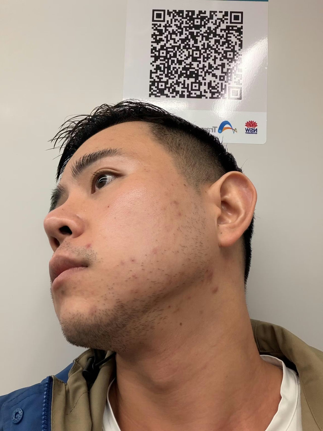 ZenCell™ Acne Blemish Skin Restore Serum