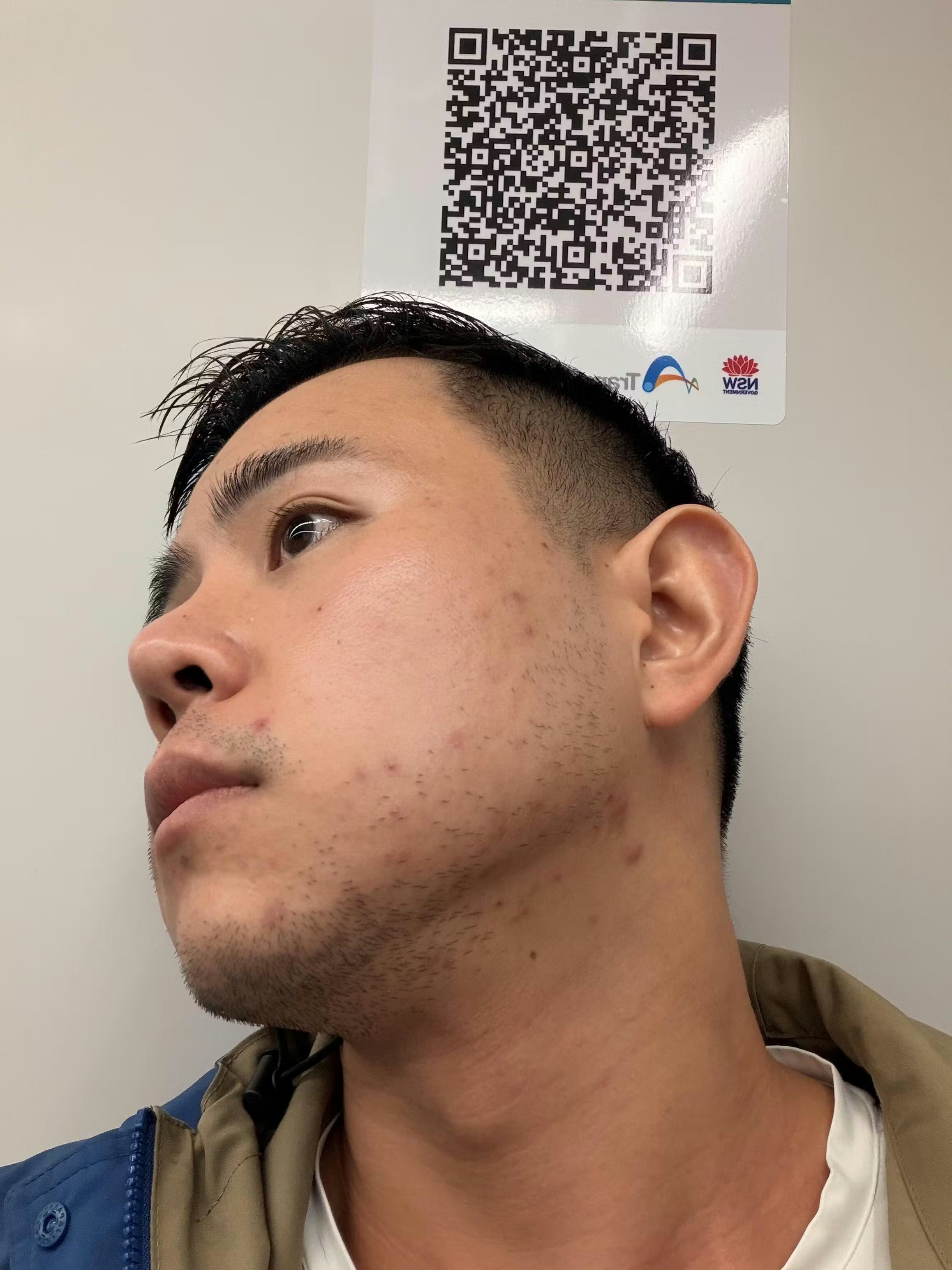 ZenCell™ Acne Blemish Skin Restore Serum